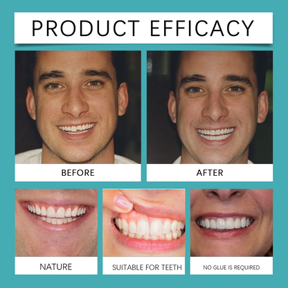 Perfect Smile Veneer (Upper & Lower Included)